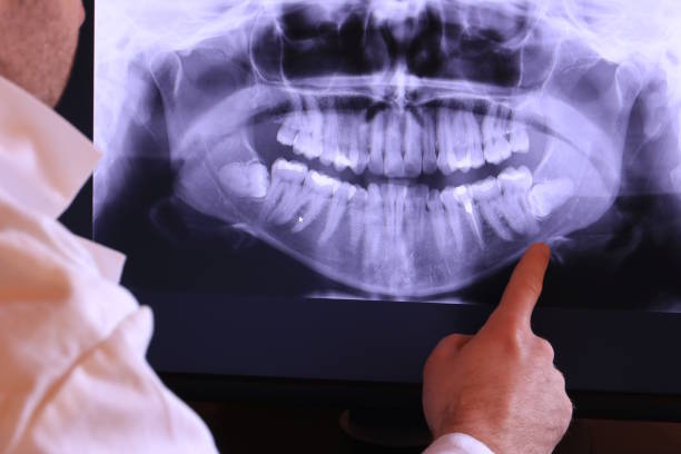 Best Emergency Dental Surgery in Twin Lakes, VA